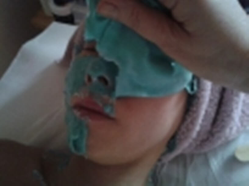 Aknebehandlung